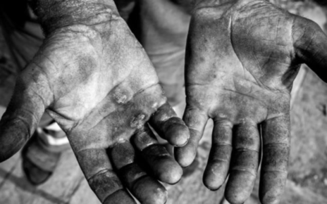 Escravidão: crescem os casos, diz o MPT