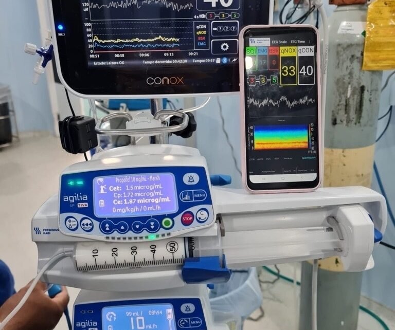 Chega ao Brasil novo aparelho de monitoramento de anestesia