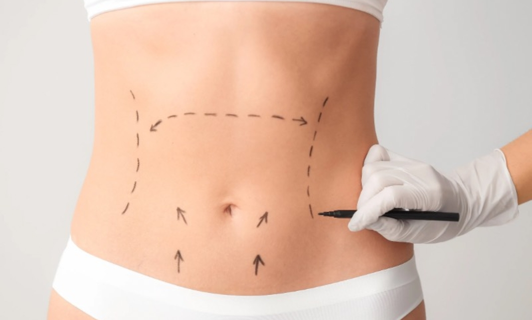 Avanços técnicos ajudam a reduzir cicatrizes cirúrgicas